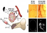 포스텍 등 국내 연구진, 홍합 접착 단백질 이용한 주사형 뼈 재생 세포치료기술 개발