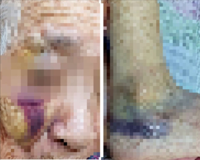 영덕 요양시설관련사진.jpg